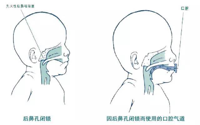瓦斯电闭锁包括故障闭锁吗,瓦斯电闭锁实验怎么做?2024/6/